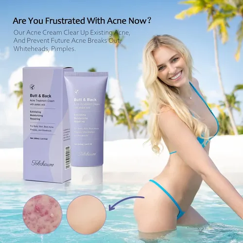 Crema Corporal Antiacné Loción Loción 130g Para Espalda