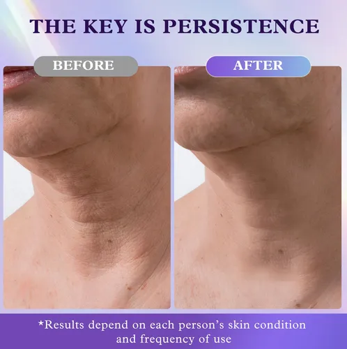 Crema Reafirmante Para El Cuello Ukvoa Antienvejecimiento Co