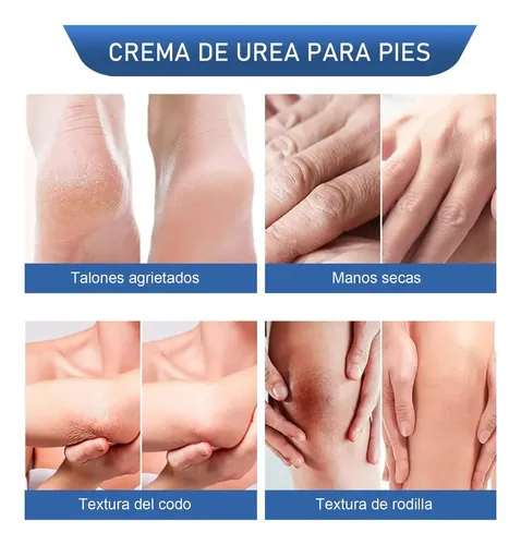 Crema Hidratante Pies Y Manos Urea 50g