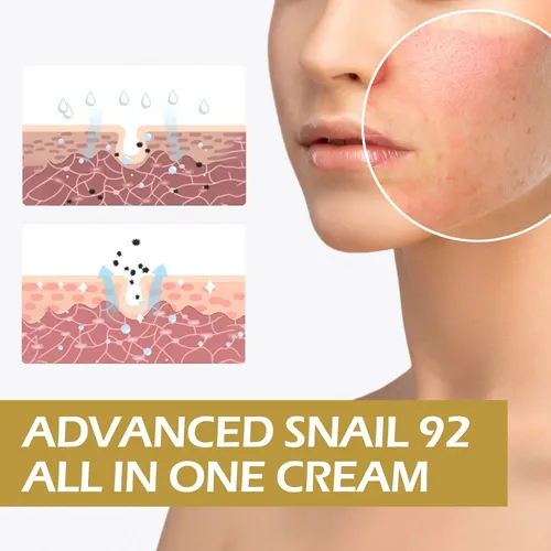 Crema Reparadora Eelhoe Snail 92 Para Hidratar Y Cicatrizar