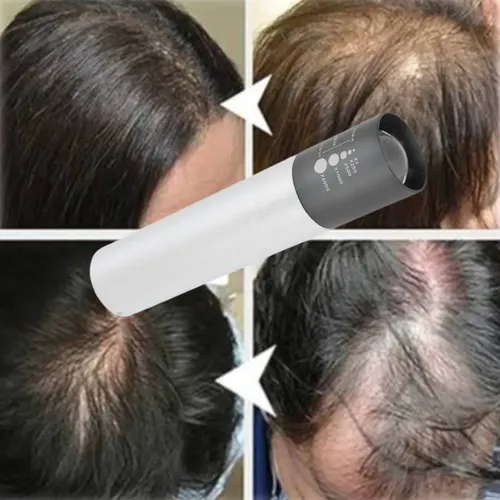 Serum Vitalidad Pelo Fuerte + Láser Portable Estimula Grosor