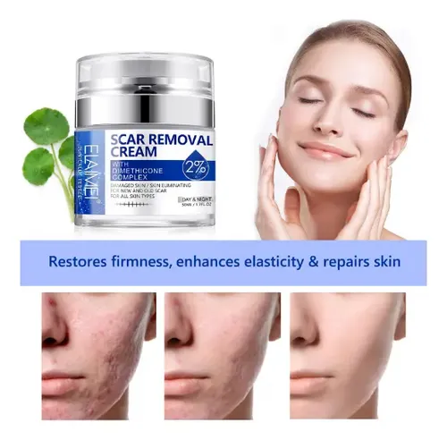 Crema Reparadora Eliminadora De Cicatrices – Pomada Cicatriz