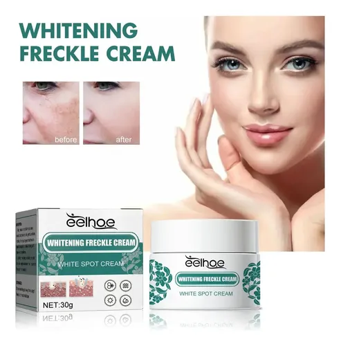 I Crema Iluminadora Facial Eelhoe Manchas Melasma Manchas Y