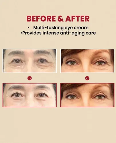 Seoul 1988 Crema Ojos Retinal Liposome 4% 30 Ml