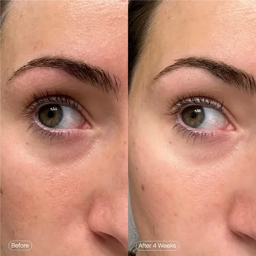 13 Conjuntos Skincare For Aclarar Topicals Faded Under Eye