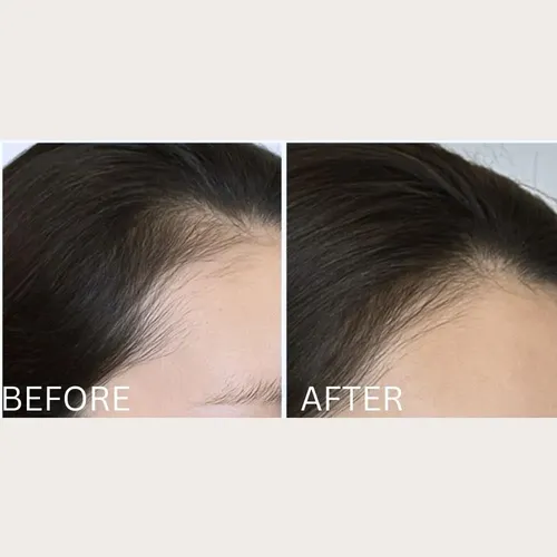 Cepillo Estimulante Para El Cabello Solaris Laboratories Ny