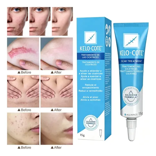 Crema En Gel Reparadora Para Queloides, Acné, Quemaduras Y C