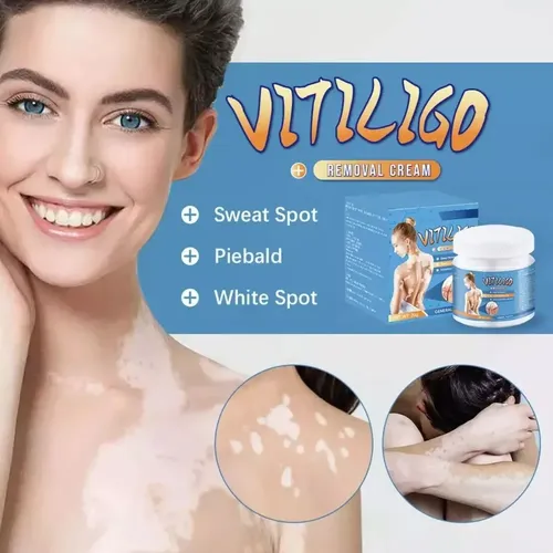Topara Crema Para Vitíligo, Elimina Las Manchas Blancas P