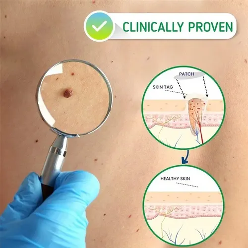 Crema Para La Eliminación Instantánea De Manchas Removedor