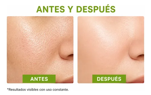 Serum Facial Ácido Hialurónico 4 En 1 Niacinamida Mely Mixta