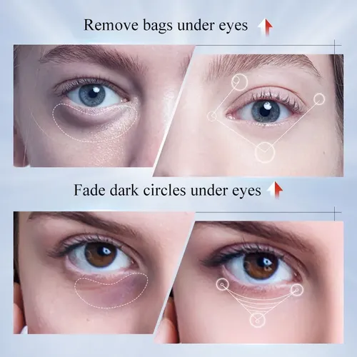 Crema Contorno De Ojos Sadoer Con Ácido Kójico Y Retinol Todo Tipo De Piel Día/noche
