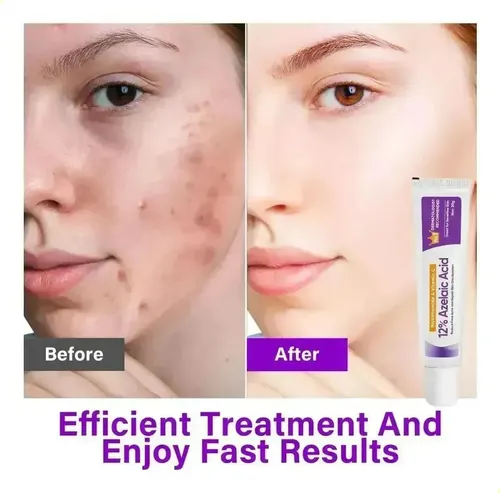 Crema Facial Con Extractos Vegetales Cuidado Piel