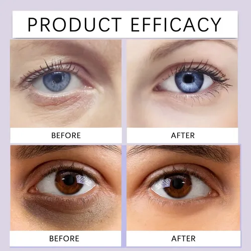 Cc/crema For Párpados Caídos, For Hidrata Y Reduce Las Oje .
