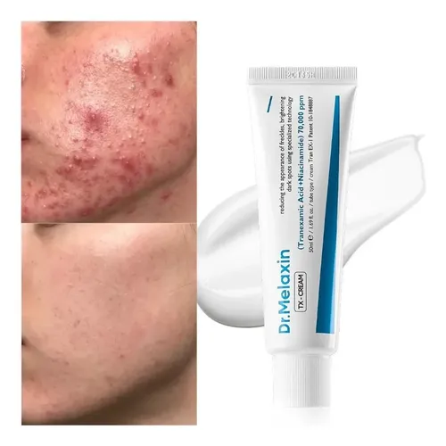 Crema Facial Despigmentante Y Anti Manchas Pack X2 Aurivela