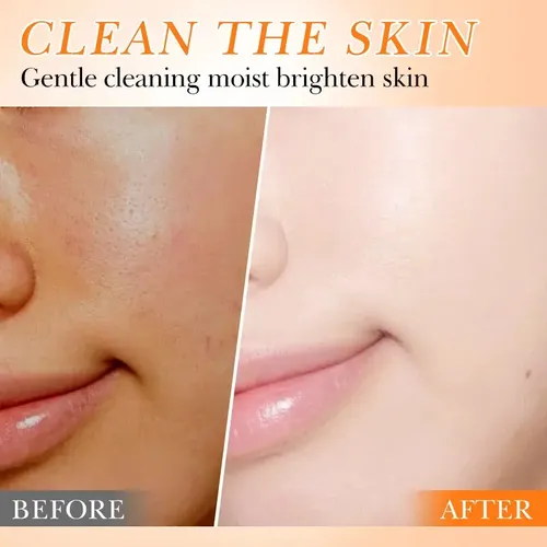 Jabon Facial Vitamina C Bioaqua Momento De Aplicación Día/noche Tipo De Piel Todo Tipo De Piel