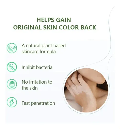 Y 4crema For Vitíligo Crema For Quitar Las Manchas Y