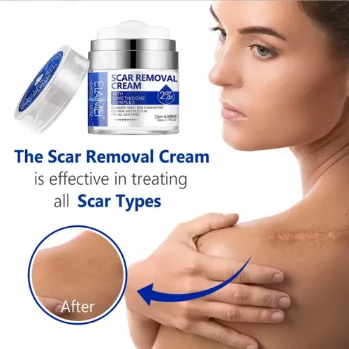 Crema Reparadora Eliminadora De Cicatrices – Pomada Cicatriz