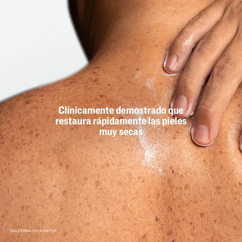 Cetaphil Pro Urea 10% Loción Hidratante Pieles Secas Ásperas