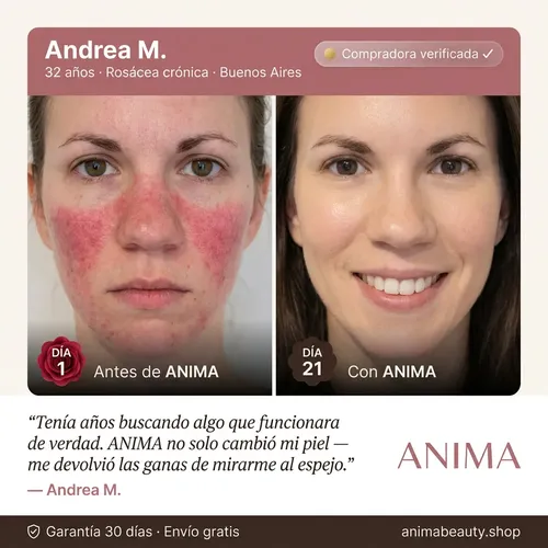 Anima Crema Natural Correctora Rosácea Y Acné 110g