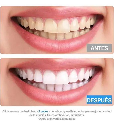 Irrigador Bucal Portátil Inalámbrico Recargable 3 Modos Blanco