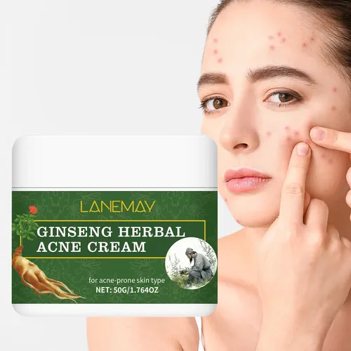Crema Para El Acné Para Piel Sensible Y Grasa 50g