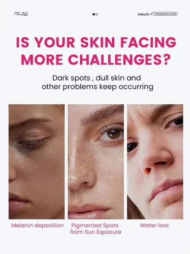 Crema Facial Purificadora De Piel Con 7% De Arbutina Y 4% De