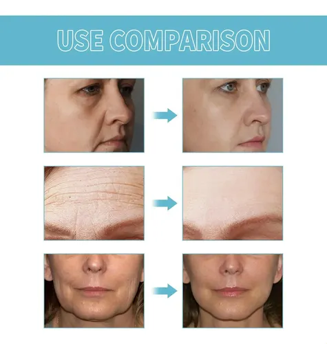 Crema Antienvejecimiento Boost Lift, Hidratante Y Antiarruga