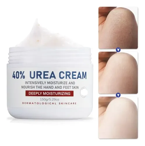 Crema For Pies Con 40% De Urea .