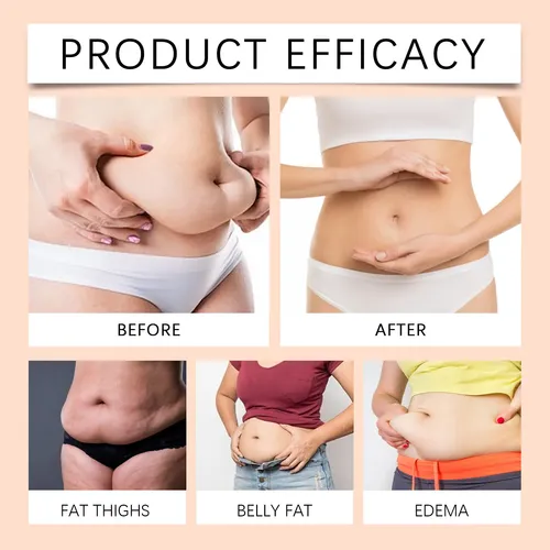 Crema Caliente Reafirmante Cuerpo Y Abdomen 100g