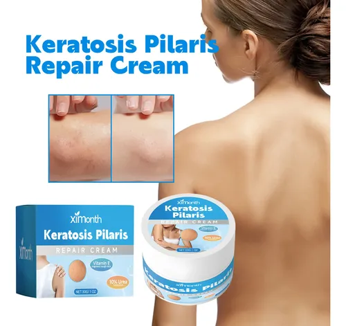Crema Ximonth Para Queratosis Pilaris: Hidratante E Iluminad