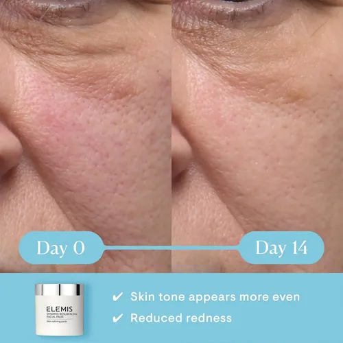 Almohadillas Faciales Elemis Dynamic Rejuvenfacing De 60 Uni