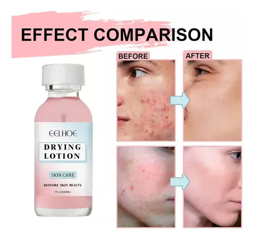 Af – Loción Facial For El Cuidado Del Rostro 30ml