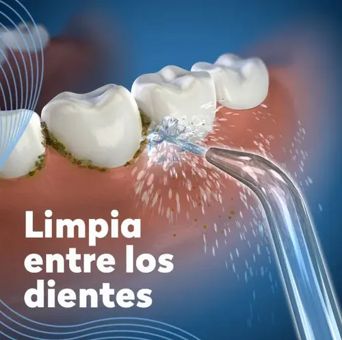 Repuesto Boquilla Waterpik Jet Tip Jt-70e Punta Hilo Dental Color