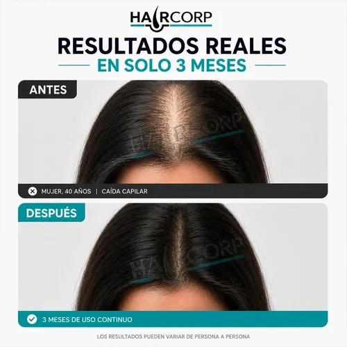 Shampoo Anti Caída Haircorp – Recupera Tu Cabello – Detiene la caida y genera crecimiento