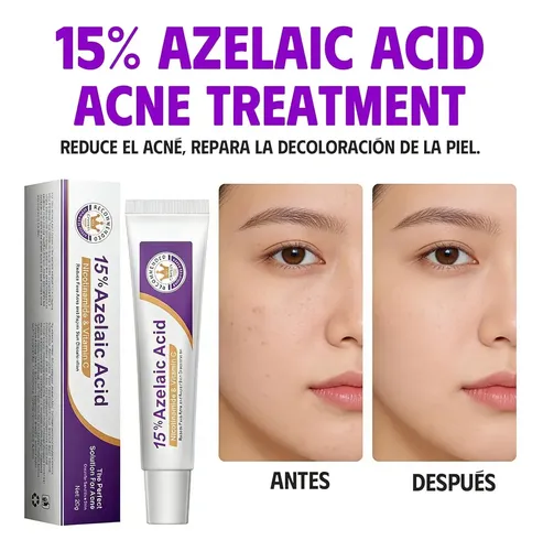 Crema Facial Con Ácido Azelaico Al 15%