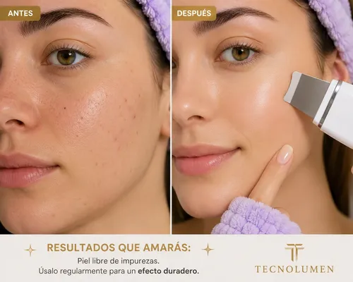 Kit Skincare Vincha Muñequeras Espátula Ultrasónica Facial