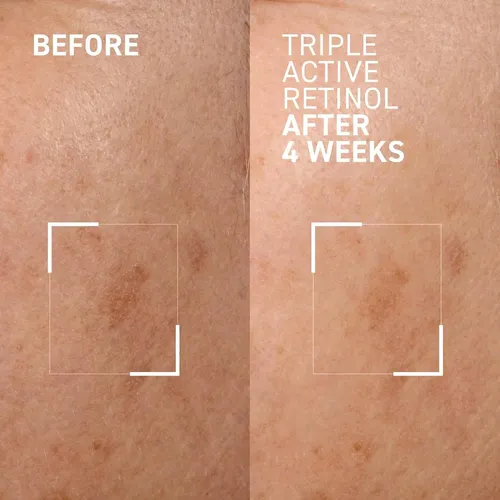Dr. Brandt Retinol Noche Triple Activo 1 Oz