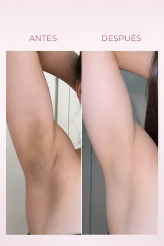 Crema Blanqueadora Corporal Ultra Potente