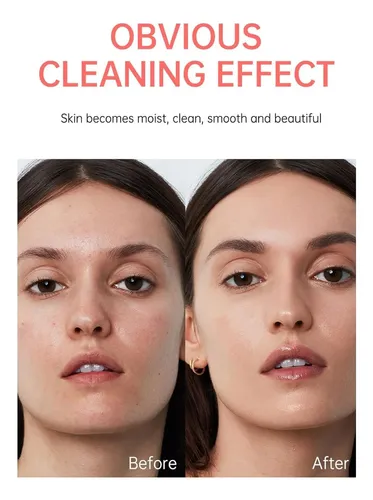 Crema Exfoliante Facial Y Corporal