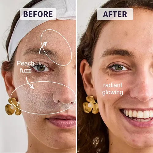 Kit Dermaplaning 9 Piezas Solar Veil Para Mujer