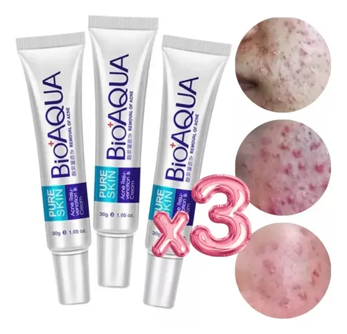 Paquete 3 Cremas Bioaqua Puntos Negros Anti Acne