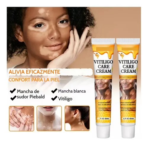 Crema Reparadora De Manchas Blancas Para El Vitíligo *3h
