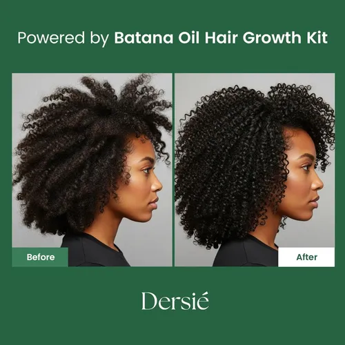 Kit Cuidado Capilar Dersie Aceite Batana Y Shampoo 118ml