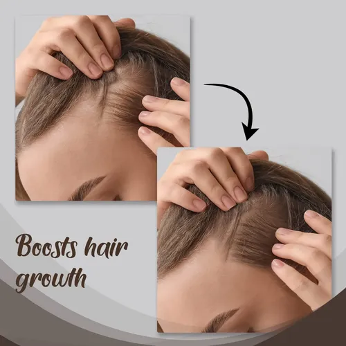 Sérum Para El Cabello Herstyler Con Aceite De Ricino Con Vit