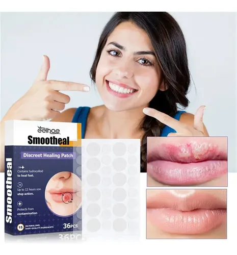 Tn 3 Parches Útiles For Aliviar El Herpes Labial Y Curar