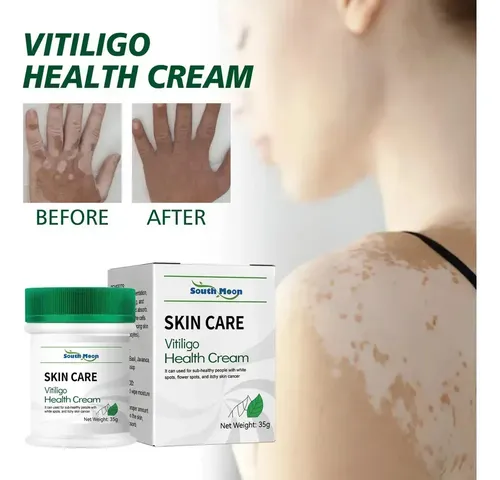 Cjw Tn 3 × Pomada Localizada Creme Vitiligo Branco M Para