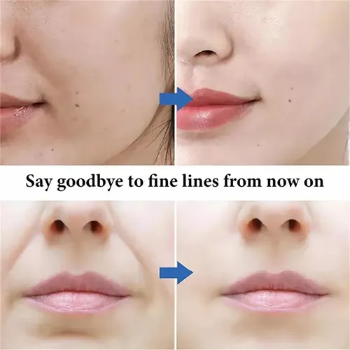 Crema De Urea Para Atenuar Manchas,crema De Urea Para Rostro