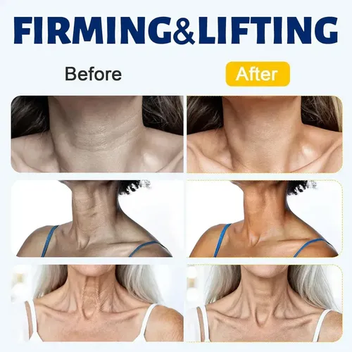 # , Loción Hidratante Para El Cuello, Crema Para El @