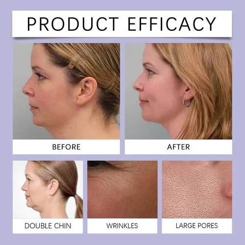 Crema Antiedad Antiarrugas Hidratante Y Reafirmante Para Ros
