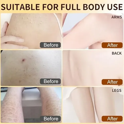 Esencia Hidratante Exfoliante Con Arroz Negro